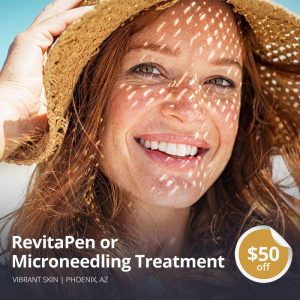 Microneedling promotion